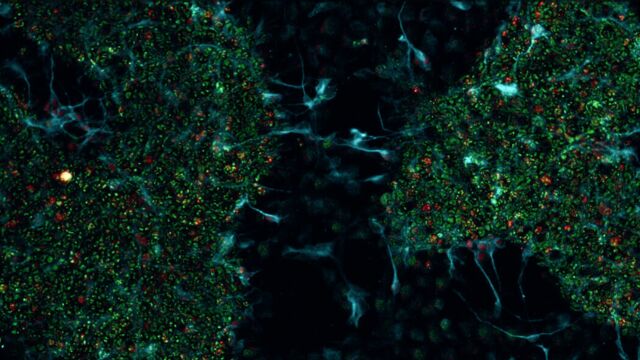 Detalle de las células utilizadas por Cortical Labs