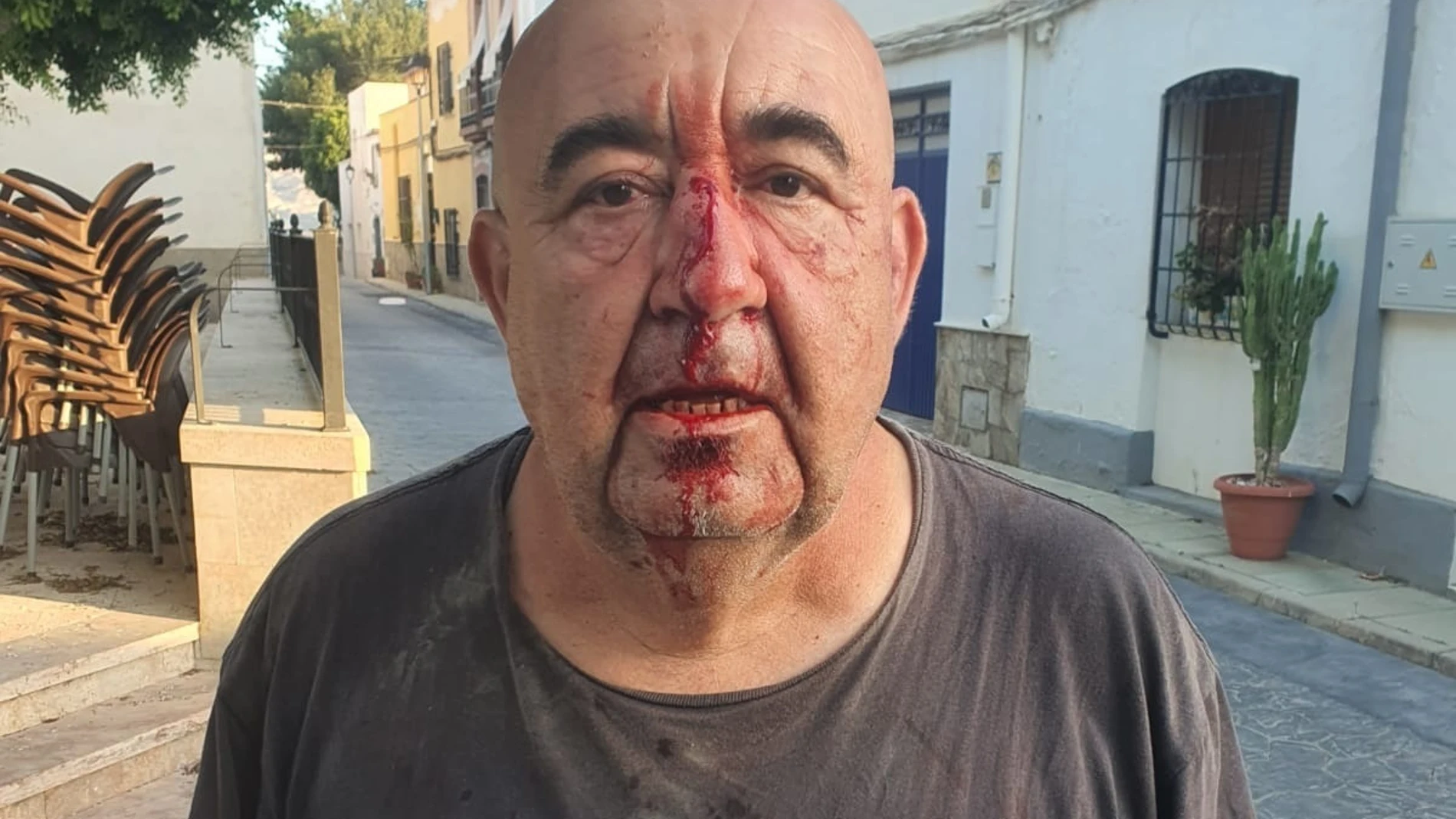 Rompen la nariz a un concejal del PSOE de Alsodux (Almería)