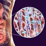 La bacteria Helicobacter tiene relación con el cáncer gástrico