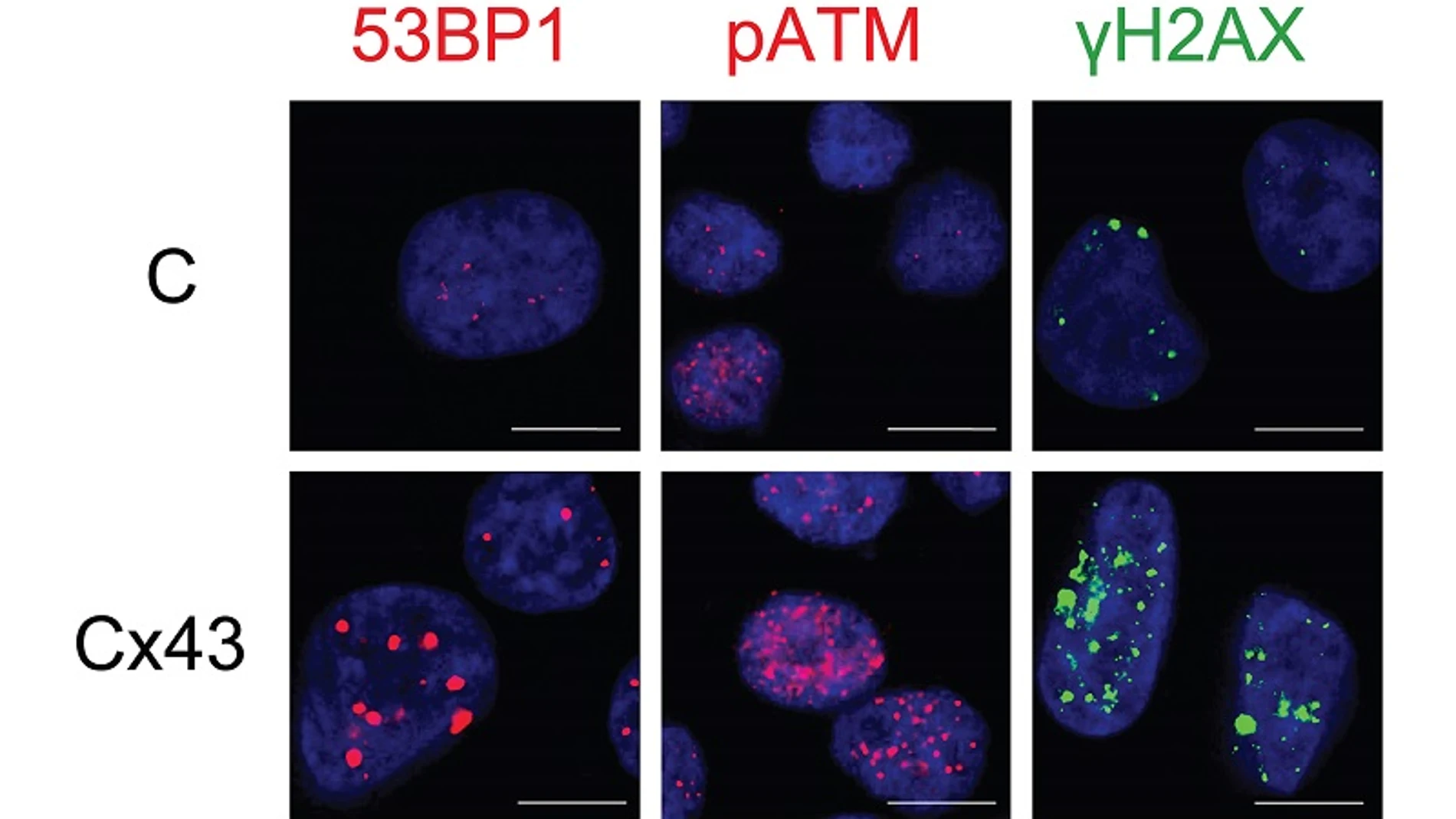 Microscopía de fluorescencia de células tumorales en cultivo, en ausencia (arriba) y presencia (debajo) de conexina 43 (Cx43).