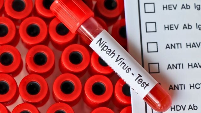 Virus Nipah