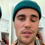 Justin Bieber sufrió una parálisis por el virus zóster
