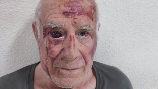 No fue un robo, fue diversión: la escalofriante agresión a un anciano de 70 años en Murcia