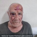 No fue un robo, fue diversión: la escalofriante agresión a un anciano de 70 años en Murcia