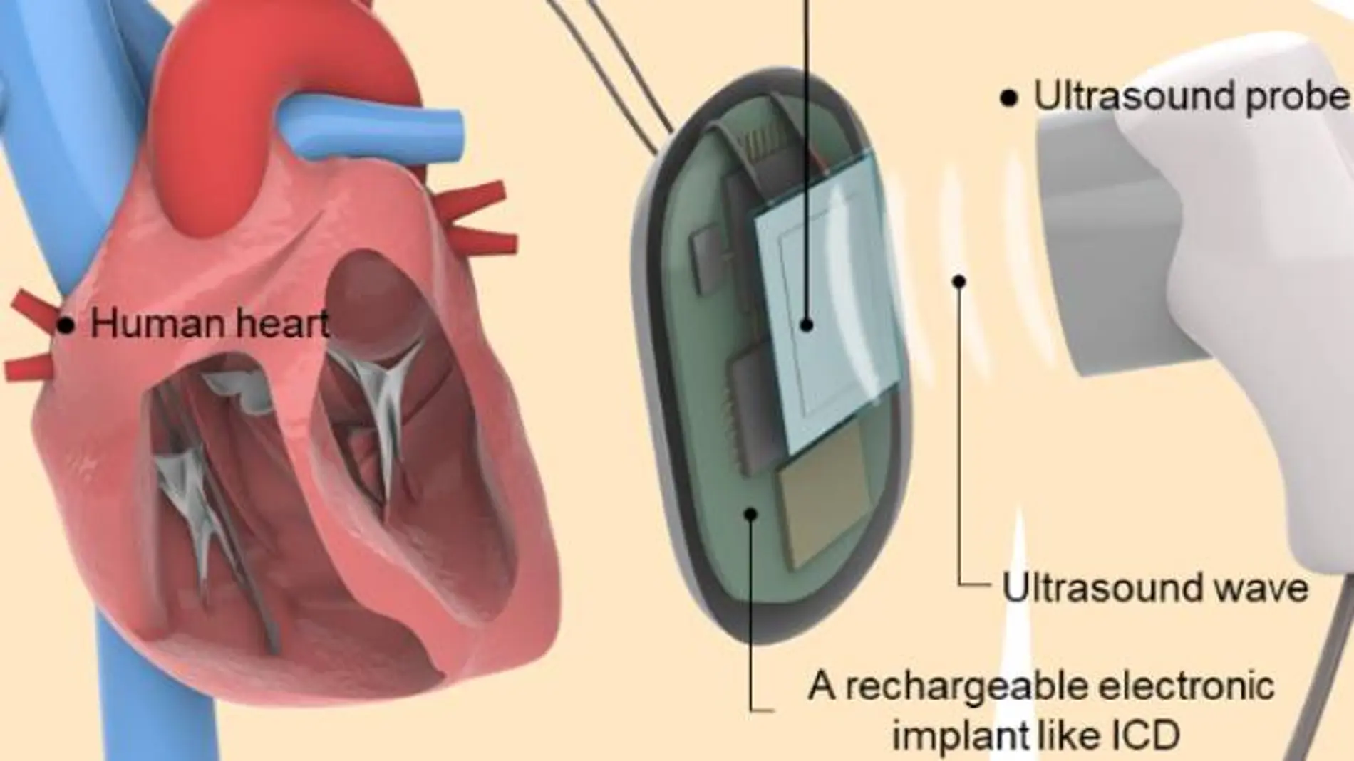 Desarrollan una tecnología de ultrasonidos para cargar dispositivos a través del agua y de la piel.