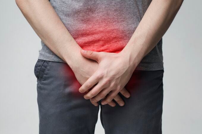 La candidiasis es producida por el hongo Candida albicans, que causa picor y ardor