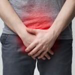 La candidiasis es producida por el hongo Candida albicans, que causa picor y ardor