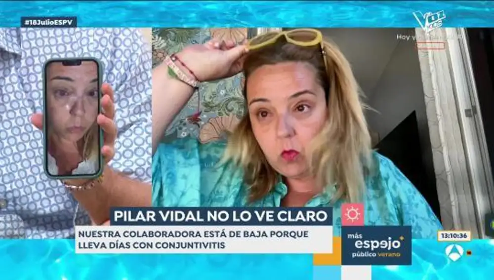 Pilar Vidal con conjuntivitis