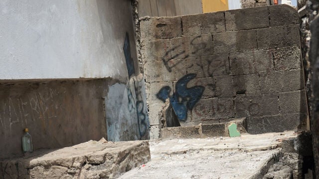 El Juzgado de Violencia contra la Infancia y la Adolescencia de Las Palmas asume la causa de la joven quemada