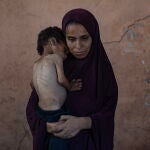 Niño palestino Yazan Abu Foul en medio de la hambruna en Gaza