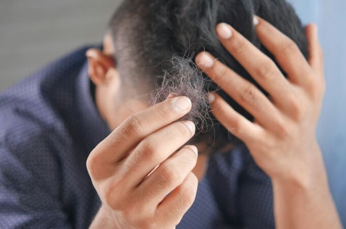 La proteína que podría cambiarlo todo: científicos descubren cómo reactivar el crecimiento del cabello de forma permanente