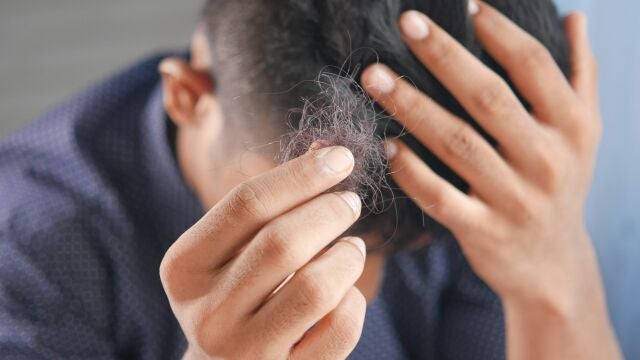 La proteína que podría cambiarlo todo: científicos descubren cómo reactivar el crecimiento del cabello de forma permanente