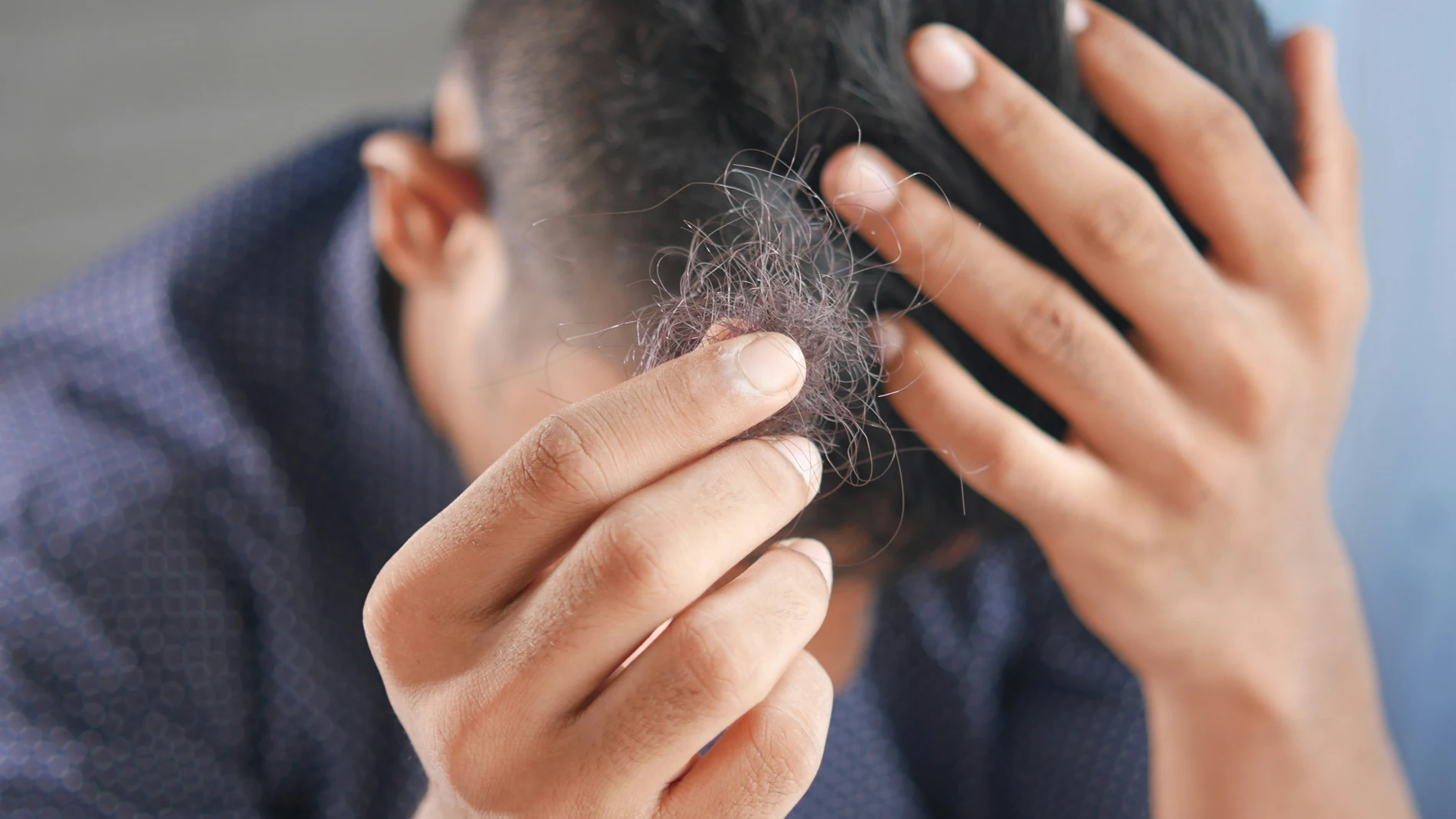 La proteína que podría cambiarlo todo: científicos descubren cómo reactivar el crecimiento del cabello de forma permanente