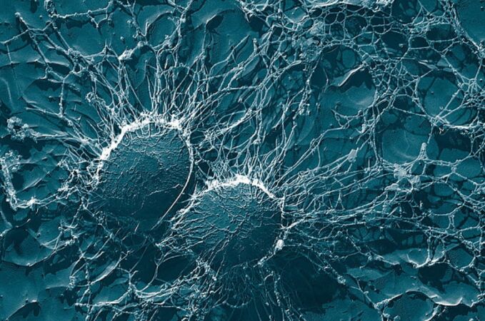 Las pruebas en células humanas con leucemia han sido muy efectivas