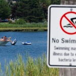 Massachusetts beach closures due to bacterial levels