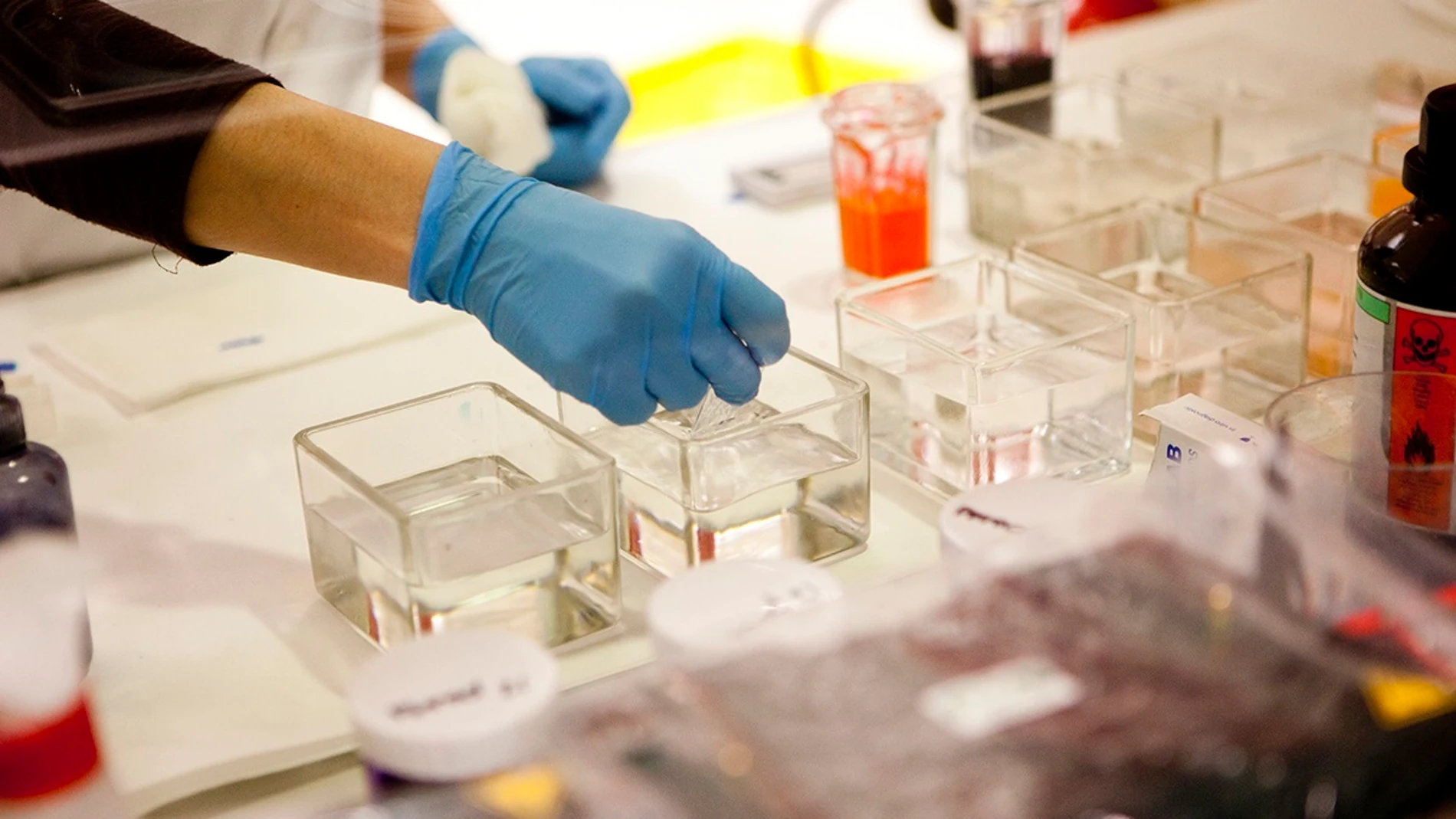 Imagen de archivo de una investigación clínica.