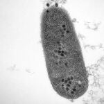 Bacterias infectadas por fagos. Los puntos muestran la replicación de los fagos.