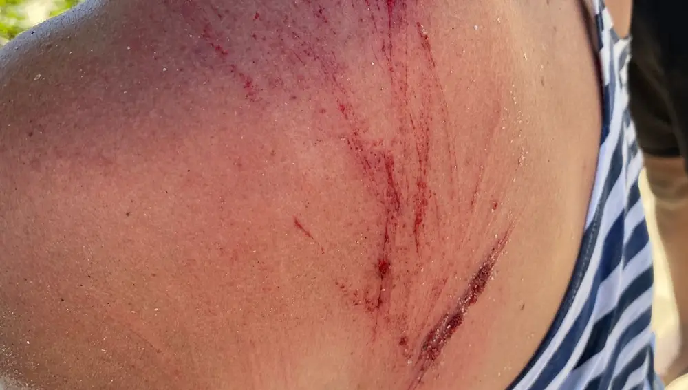 Imagen de las heridas exteriores sufridas.