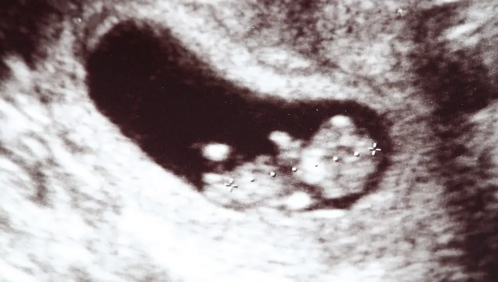 El paso de ADN fetal a la madre puede darse la semana 10 de embarazo