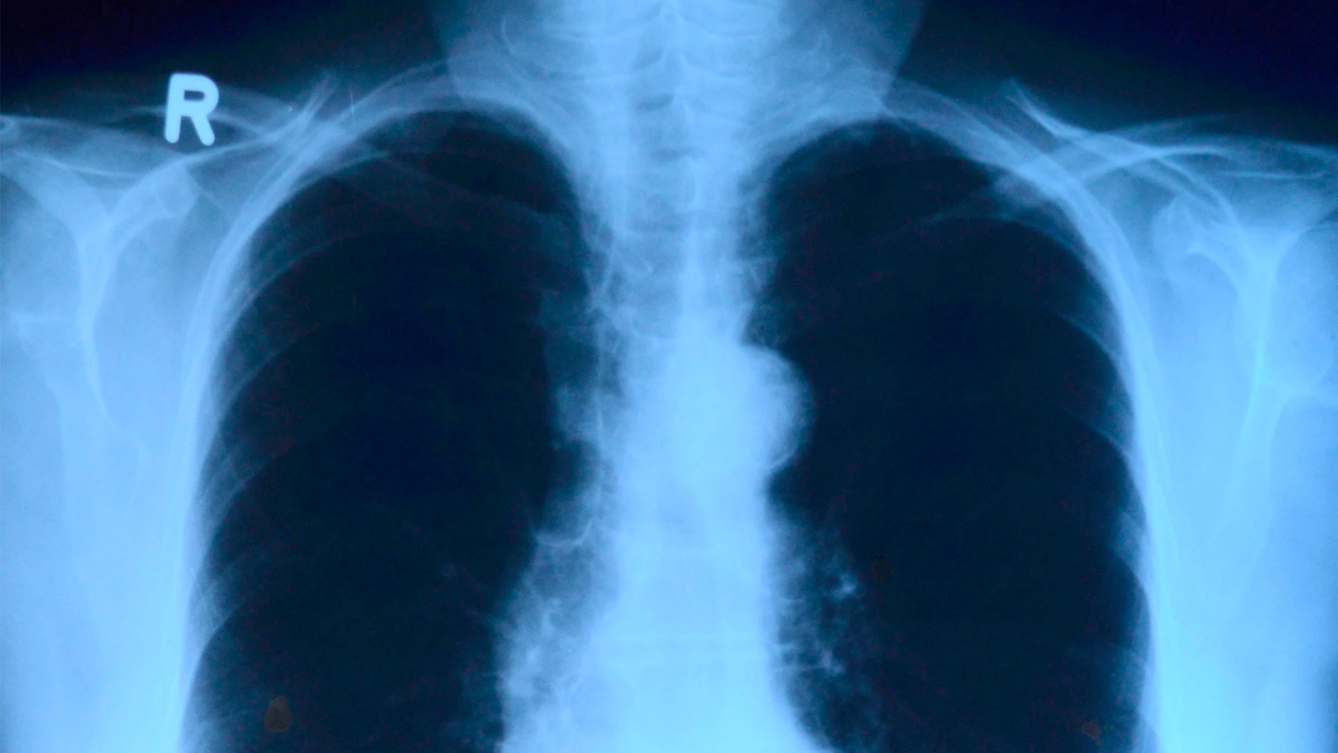 Tus pulmones sufren las consecuencias