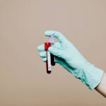 Tubos de ensayo con muestras sanguíneas