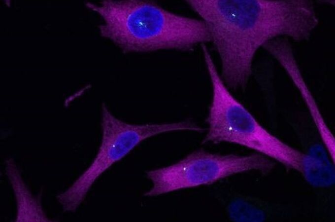 Descubren un "sistema GPS" del melanoma que podría frenar la metástasis