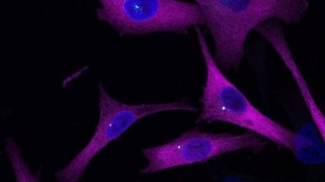 Descubren un "sistema GPS" del melanoma que podría frenar la metástasis