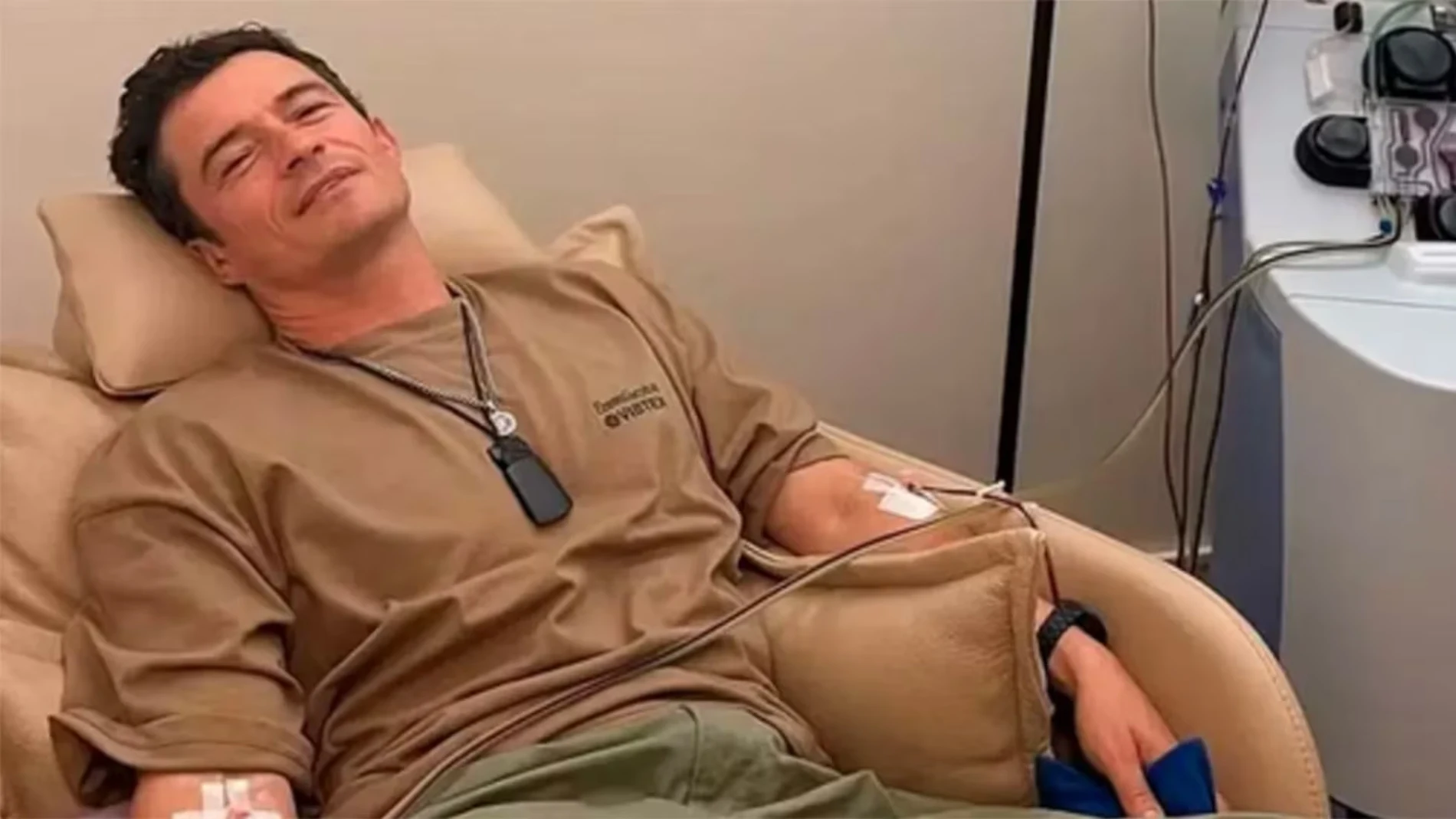 Plasmaféresis, la técnica de Orlando Bloom para “limpiar” la sangre de tóxicos y microplásticos