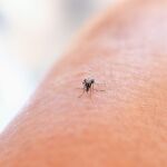 Las picaduras de mosquitos son habituales en verano