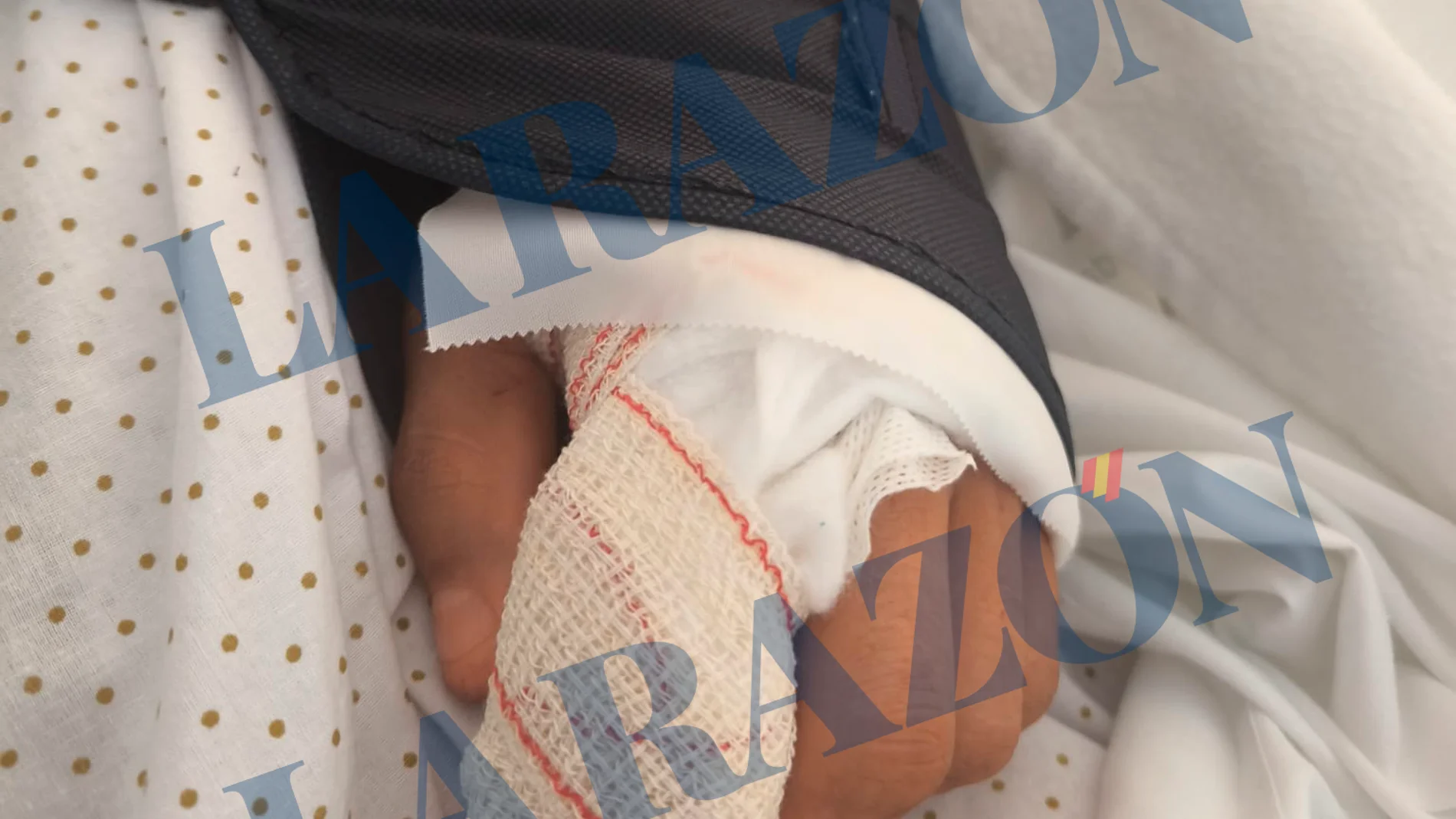 Un drogadicto amputa de un mordisco un dedo a un guardia civil