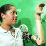 En la imagen, Claudia Mitchell muestra su mano protésica que controlada con el pensamiento
