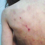 La violencia que sufren algunos de los niños que atiende Doñoro se refleja en sus cuerpos, llenos de heridas y de moretones producto de los abusos
