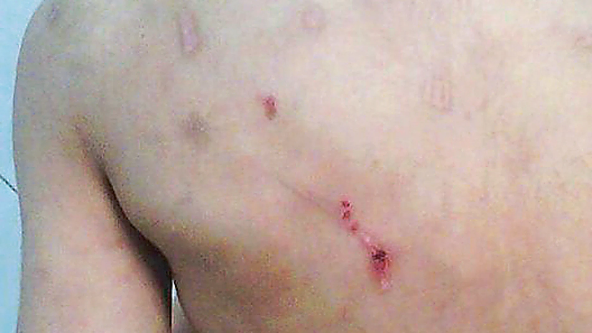 La violencia que sufren algunos de los niños que atiende Doñoro se refleja en sus cuerpos, llenos de heridas y de moretones producto de los abusos