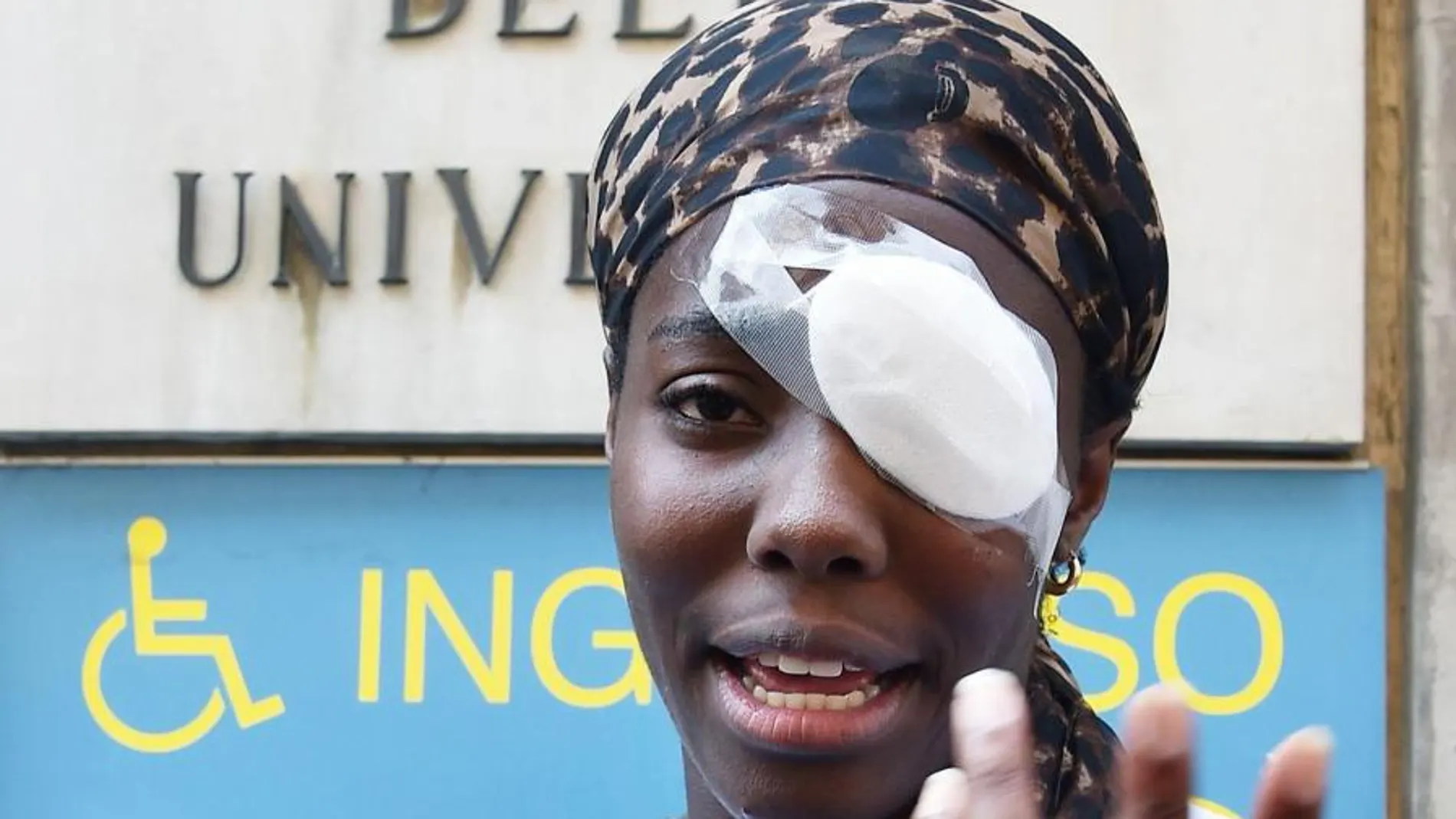 Daisy Osakue, tras su salida del hospital el pasado 30 de julio / Foto: Ap