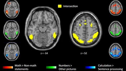Las imágenes por resonancia magnética funcional han servido para detectar las zonas que se activaban en matemáticos y personas que no lo eran frante a enunciados matemáticos de alto nivel