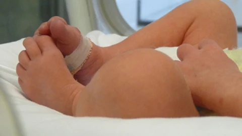 Avances en el mundo de los prematuros: la importancia del cuidado