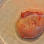 Un ovario recientemente trasplantado de una mujer, en una imagen de archivo