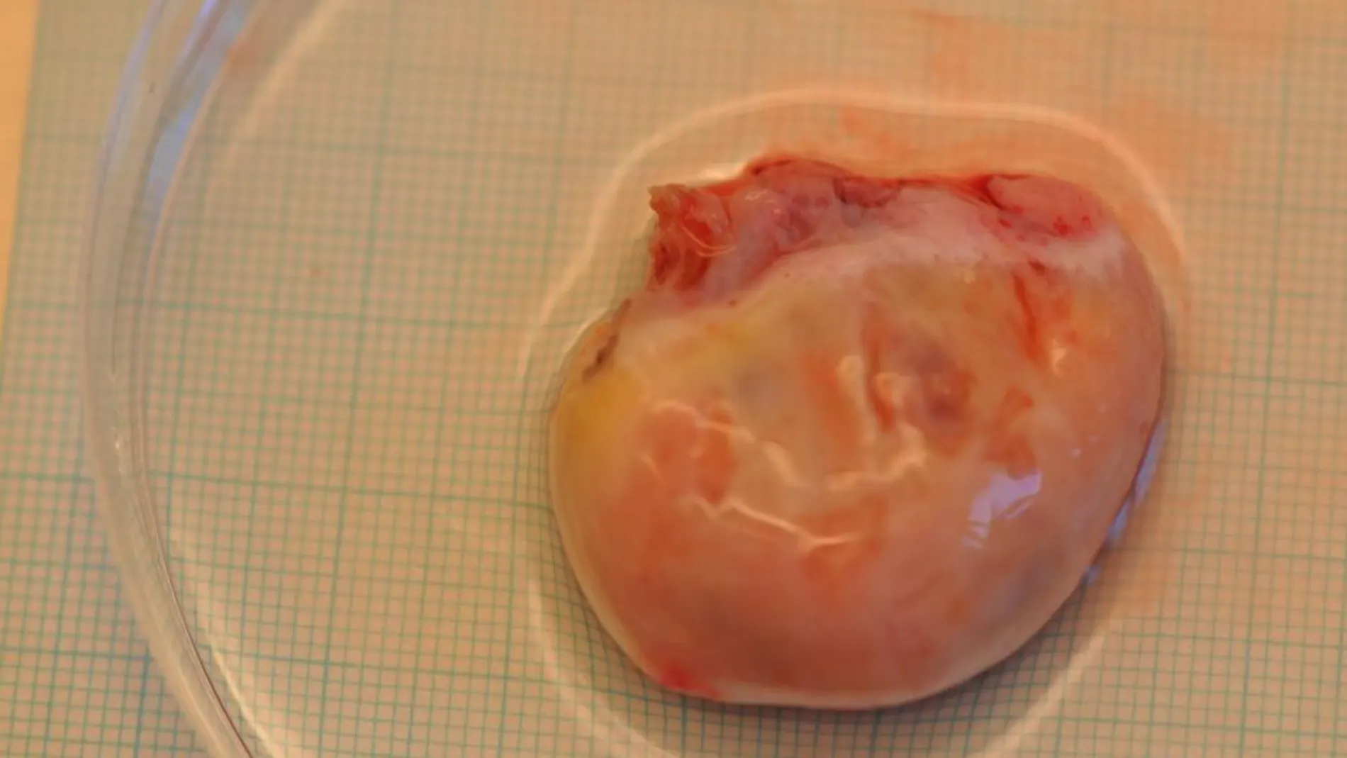 Un ovario recientemente trasplantado de una mujer, en una imagen de archivo