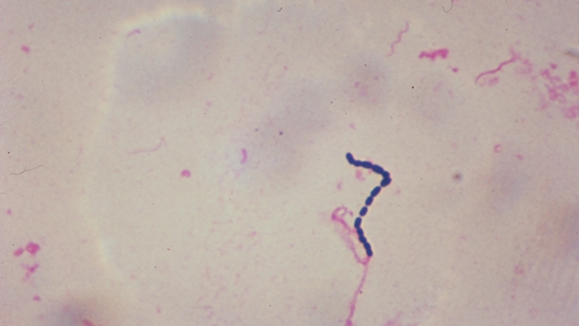 Streptococcus, uno de los microbios más frecuentes, situado en el entorno de la boca