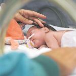 Las malformaciones pueden ser digestivas, pulmonares, genito-urinarias... Algunas comprometen la vida del bebé, pero la mayoría se puede corregir con cirugía
