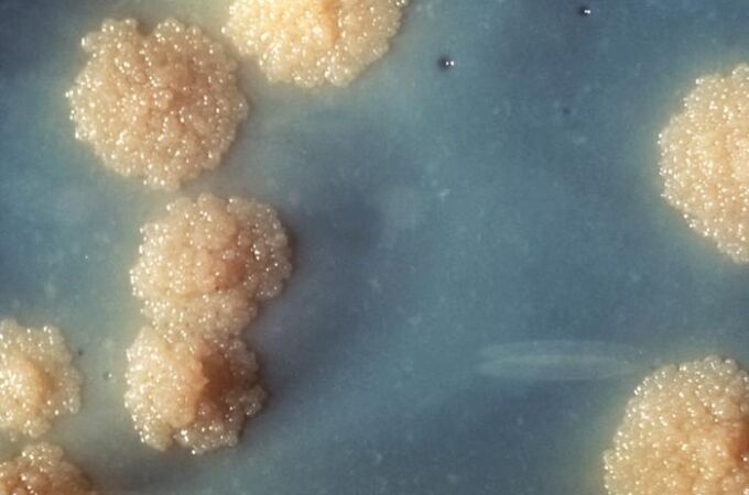 Colonias de Mycobacterium tuberculosis sobre un medio de cultivo.
