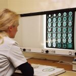 Un estudio del CSIC mejorará la terapia y el sistema de diagnóstico del linfoma de Burkitt