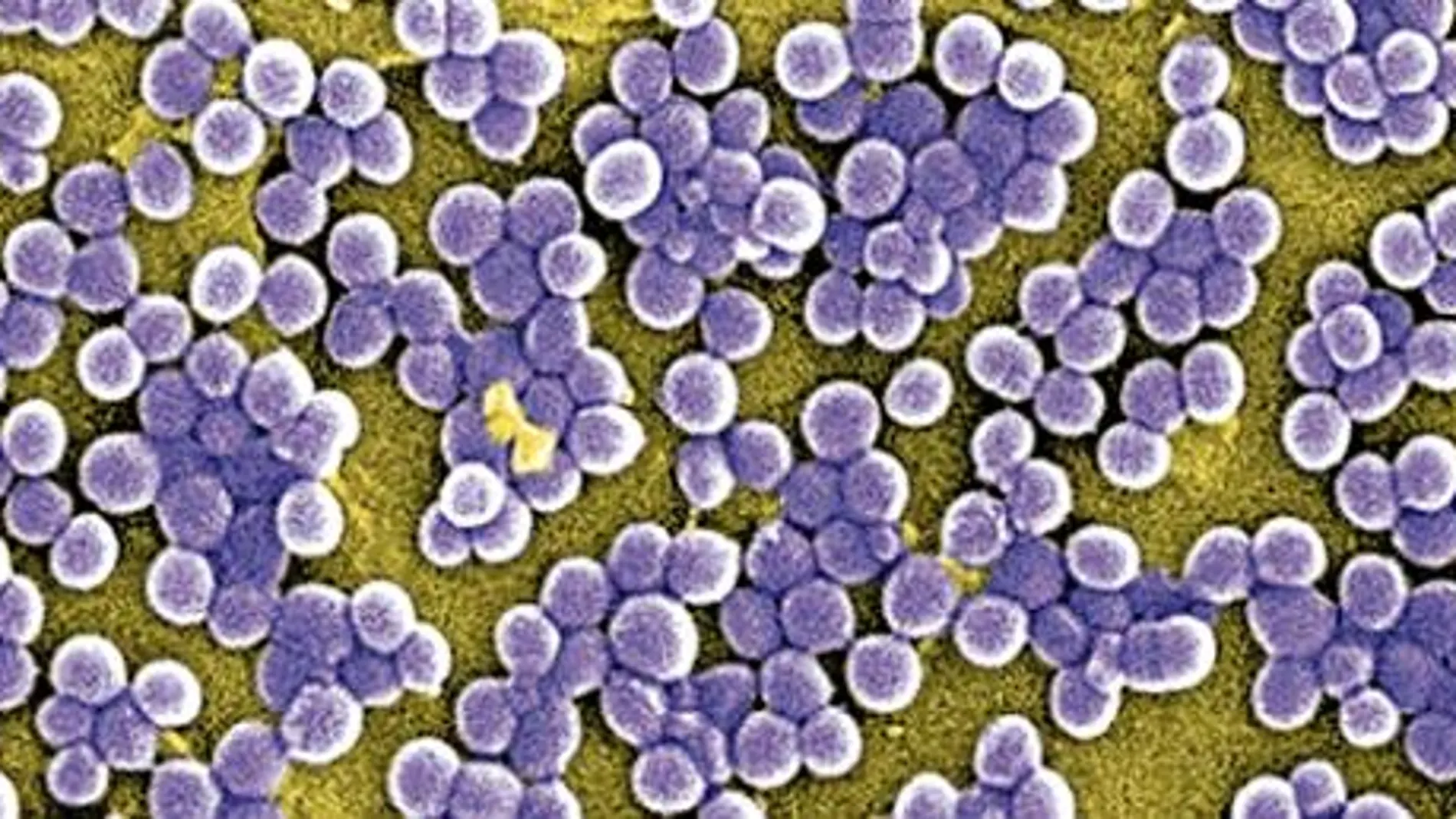 Imagen del virus del Sindrome Respiratorio Agudo Severo (SARS)