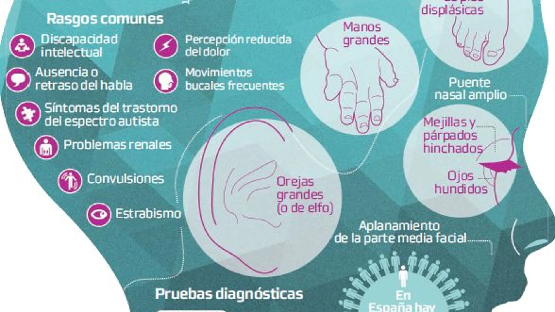 El cromosoma que les roba el habla