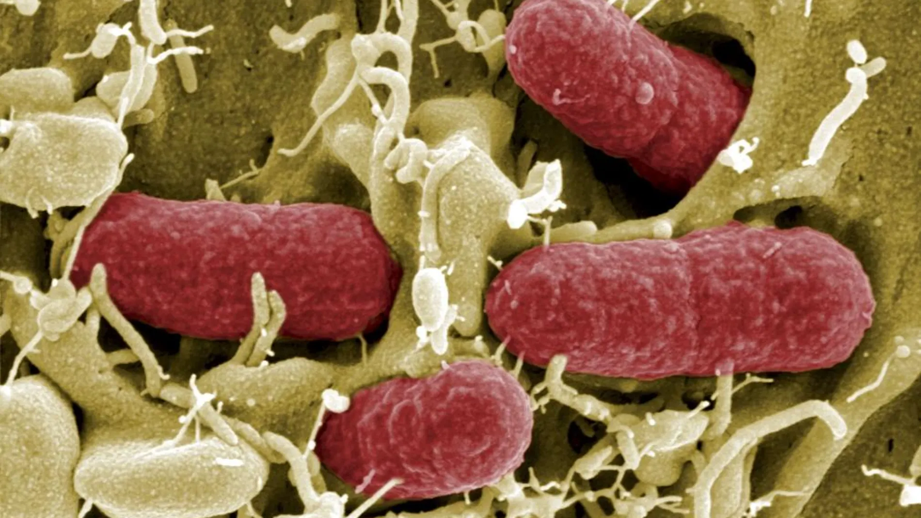 Bacterias