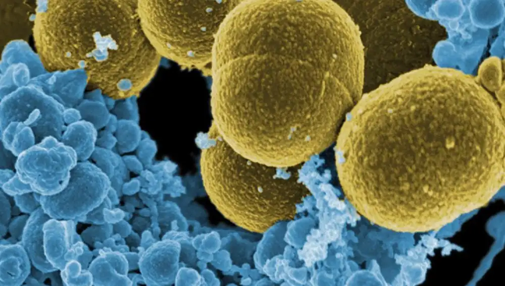 Bacterias ‘Staphylococcus aureus’ escapando de la destrucción por células blancas humanas