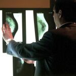 El estudio, publicado en la revista Nature, ahonda en la detección y tratamiento del cáncer de mama