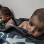 Varios niños reciben atención médica tras un bombardeo en Ghuta/Efe
