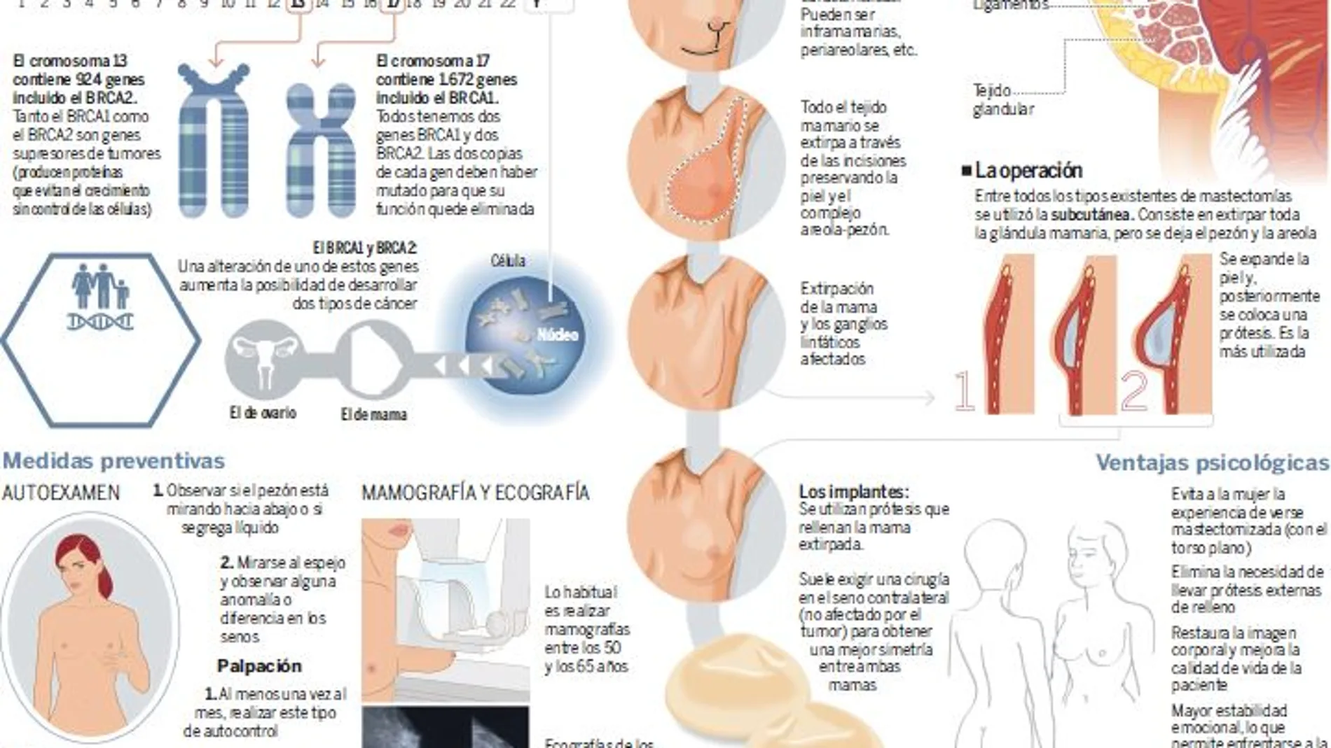 Cáncer de mama: la equidad, clave para vencerlo