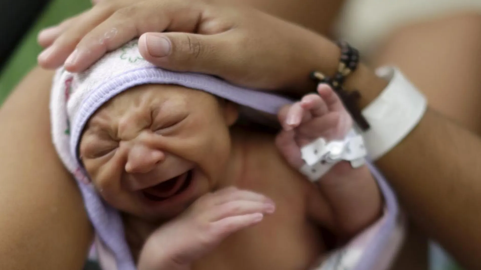 Un bebé con microencefalia